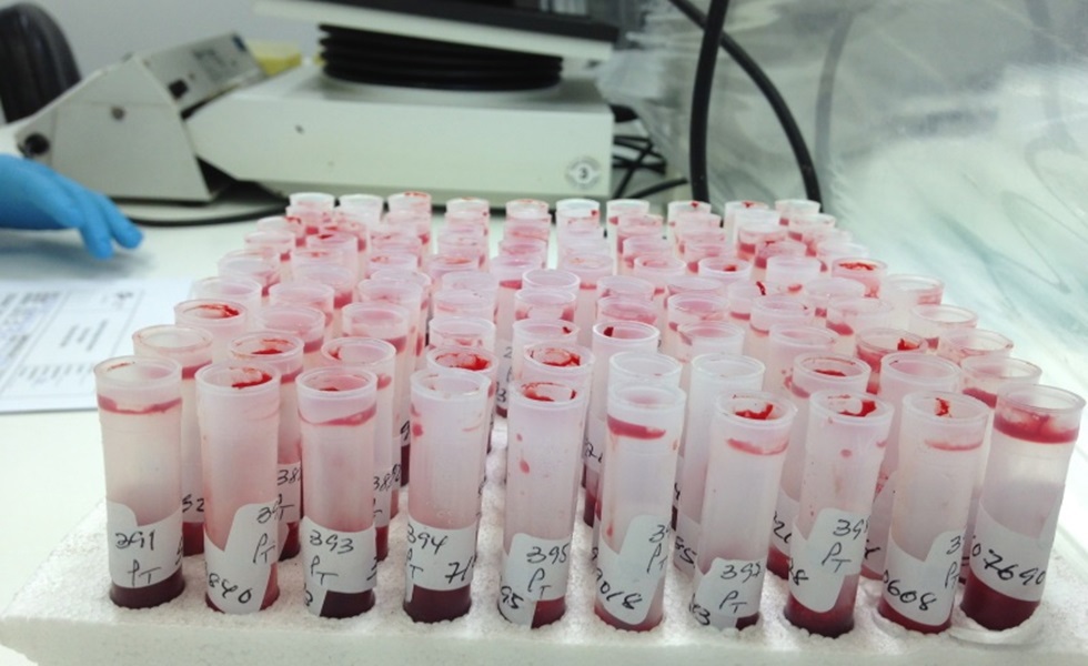 Diagnóstico serológico da Doença Hemorrágica Epizoótica (DHE).